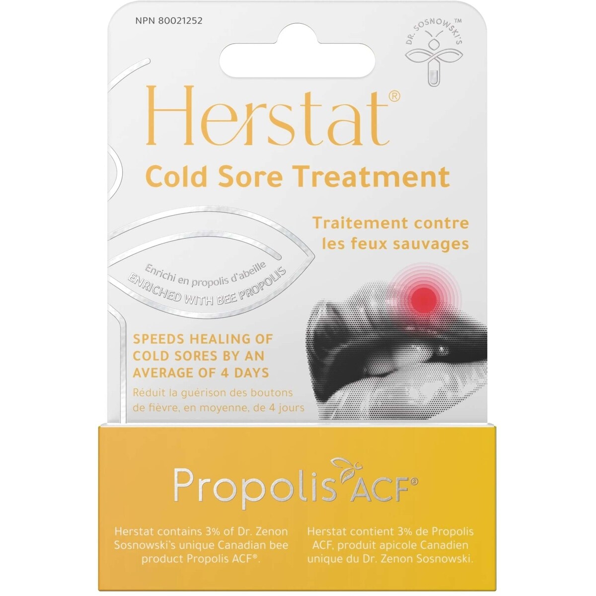 Tratamiento Contra Los Herpes Labial Herstat