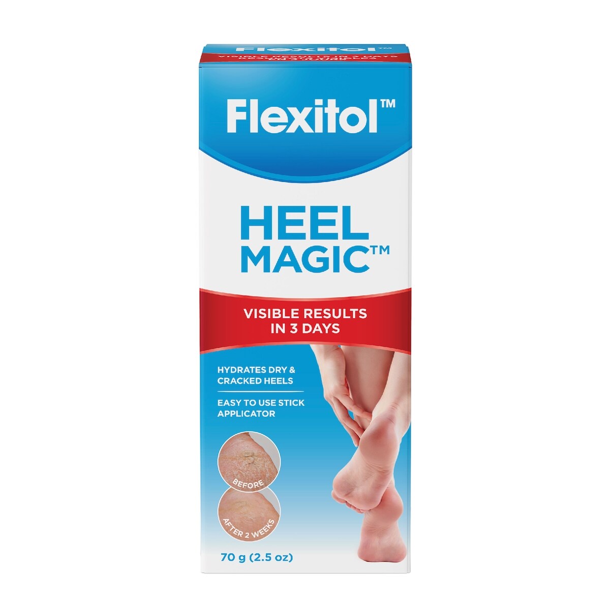 Crema de Manos Magia para Talones 70 g Flexitol